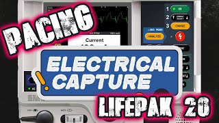 Stat Skills: Transcutaneous Pacing Using the LifePak 20