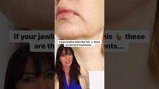 How to tackle jowls and an ageing jawline non-surgically #jawlinecontouring #jawlinefiller #jowls