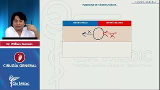 PI24   CIRUGÍA GENERAL   Abdomen agudo vascular  Isquemia de víscera sólida