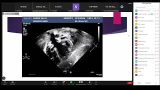 MD Congenital Tracing Revision   Dr  Dina Adel