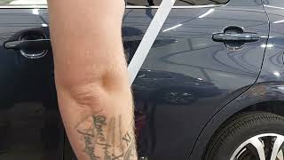 Dent removal on citroen c1... pt2 PDR removal