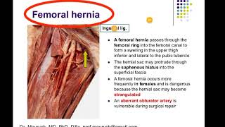 type of hernias|abdomen anatomy|fcps part-1 preparation forum|cpsp syllabus