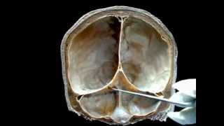 REPLIEGUES DURALES, SENOS VENOSOS, HUESO OCCIPITAL: Tópico Anatómico