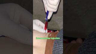 intramuscular injection