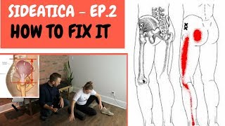 Outer Hip Pain SideAtica: How To Fix It