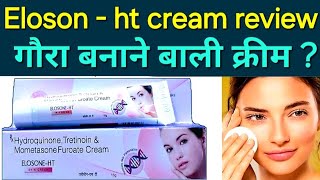 Elosone ht cream uses in hindi | how to use elosone ht cream, benefits and side effect in Hindi