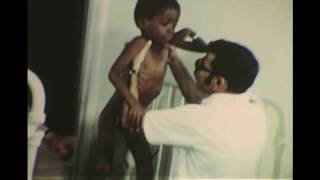 1972 Poliomyelitis Investigation in Trinidad and Tobago