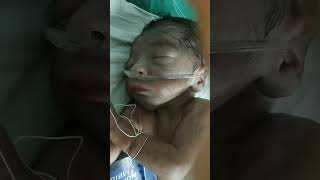 just born baby having the respiratory distress #plz pray for this baby to cure well#