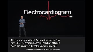 Electrocardiogram (ECG) is now Available on Your Apple Watch Series 4 through Watch OS 5.1.2