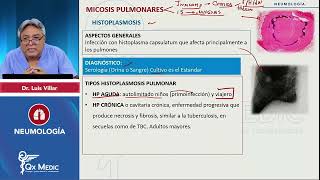 2024 NEUMOLOGÍA   Micosis pulmonares  Histoplasmosis