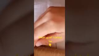 انواع الصم