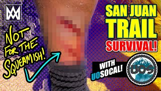 A gnarly injury and series of challenges test us on the San Juan Trail | YT Decoy Shred