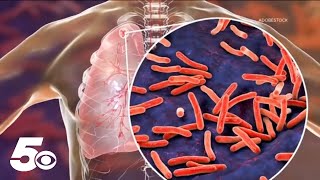 Tuberculosis on the rise in Arkansas