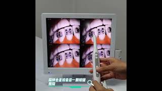 intraoral camera