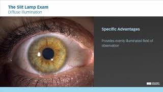 The Slit Lamp Exam - Episode 6  Diffuse Illumination