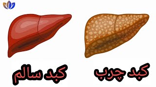 کبد (جیگر) چرب چیست؟ از علت تا درمان!!!