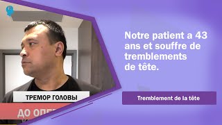 🔹Notre patient a 43 ans et souffre de tremblements de tête. / Tremblement de la tête