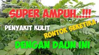 TIPS SUPER AMPUH...PANU DAN GATAL RONTOK DENGAN DAUN INI