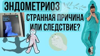 #эндометриоз Вылечить без гормонов. Причина найдена?