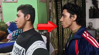 my mewing transformation (18-19) || mewing kaise kare