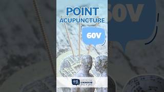 POINT D’ACUPUNCTURE - 60V / Kun Lun #acupuncture #acupuncturepoints #medecinechinoise