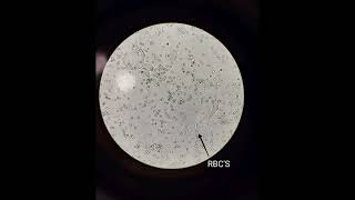 # Microscopic examination of urine ( practical) # MLT 🥼👀