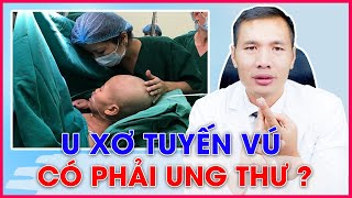 U XƠ TUYẾN VÚ có tiến triển thành UNG THƯ VÚ không? Tổng hợp A - Z về U xơ tuyến vú