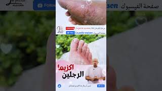 علاج اكزيما الرجلين وصفات الدكتور عماد ميزاب Docteur Imad Mizab