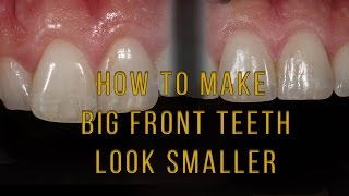 What to do if one tooth looks big and long