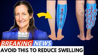 Barbara O'Neill's Natural Remedies For Swollen Legs and Feet That Works INSTANTLY