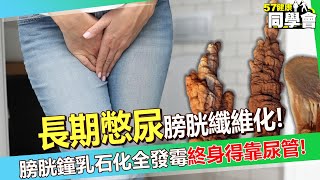 40歲女主管長期憋尿「尿不出來」才知膀胱纖維化！？ 膀胱鐘乳石化全發霉「終身得依靠導尿管」醫師嘆：沒救了！【 @57healthy  】#鄭丞傑 醫師