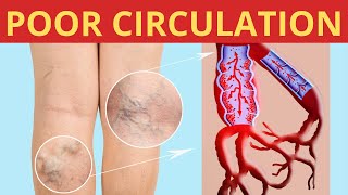 You Have Poor Blood Circulation Here's How To Solve It: Causes,  Symptoms And Treatment .