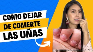 Cómo deje de comerme las uñas - Mi sistema 100% comprobado 💯