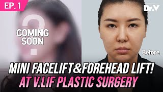 [Korea Plastic Surgery] Mini Facelift, Temporal Brow Lift at V.LIF Clinic