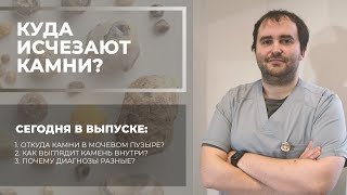 Куда исчезают камни в почках?