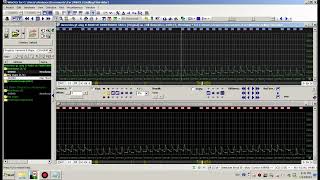 mercedes gt amg R 4000 v8 TWINTURBO 585cv como encontrar los mapas en winols