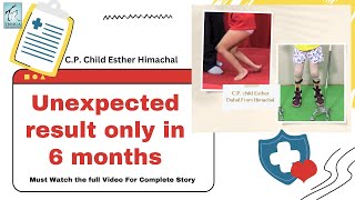 Doubt to Strides: My Daughter's CP Walking Journey (Hindi) | CP Case Study | Trishla Foundation