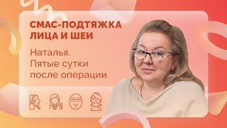 Наталья. СМАС. 5 сутки после операции