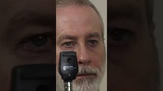 Unintentional Asmr eye examination