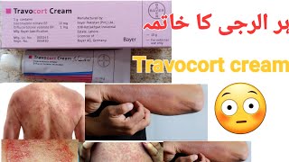 cream Travocort(isoconazole nitrate+Diflucortolone valerate)uses,benefits and dose in urdu/hindi