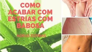 Como acabar com estrias com babosa