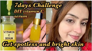 7Days Challenge||Homemade Vitamin C Serum for spotless bright Skin           #skincare #serum