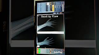 Hand X ray