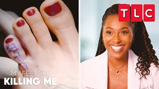 Dr. Vincent’s Most Incredible Moments | My Feet Are Killing Me | TLC