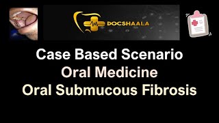 Case Based Scenario-Oral Submucous Fibrosis - Oral Medicine