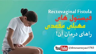 فیستول مهبلی مقعدی Rectovaginal fistula