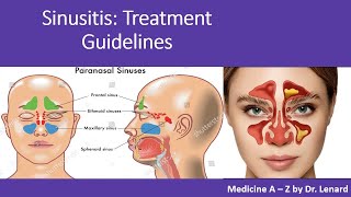 Comprehensive Guide to Sinusitis: Symptoms, Causes, Treatment, and Prevention | ABRS vs AVRS