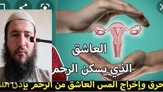 أقوى وصفة مجربة لحرق #مس _#الأرحام# والمبايض# وإخراجه🔥🔥