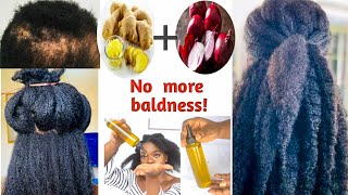 stop balding and hair breakage #shorts #haircare #hairgrowth