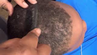 Dandruff Scratching on My Son + Hair Wash Sound On #2 #dandruff #hair #flakes #itchydryscalp #asmr